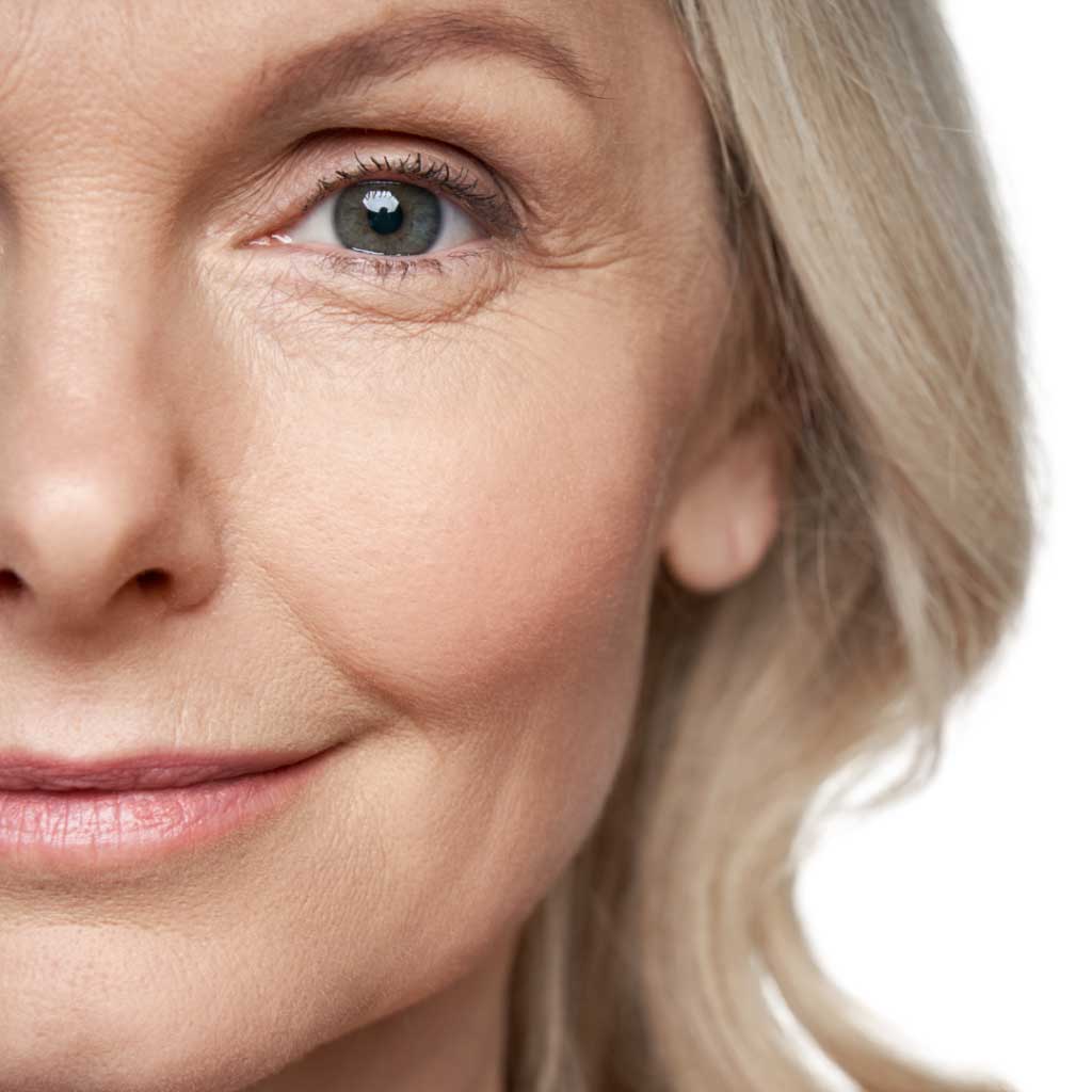 Vorberg Beauty Clinics Lidkorrekturen