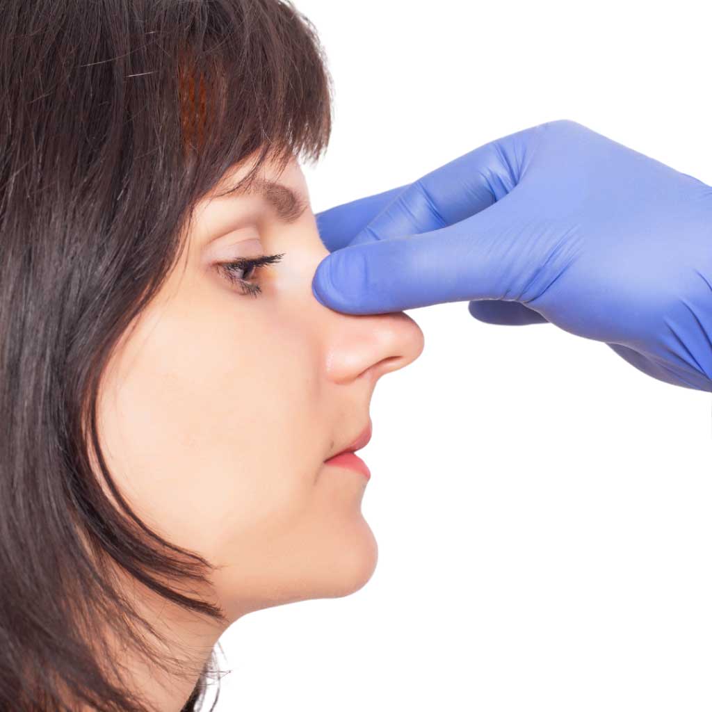 Vorberg Beauty Clinics Nasenkorrekturen
