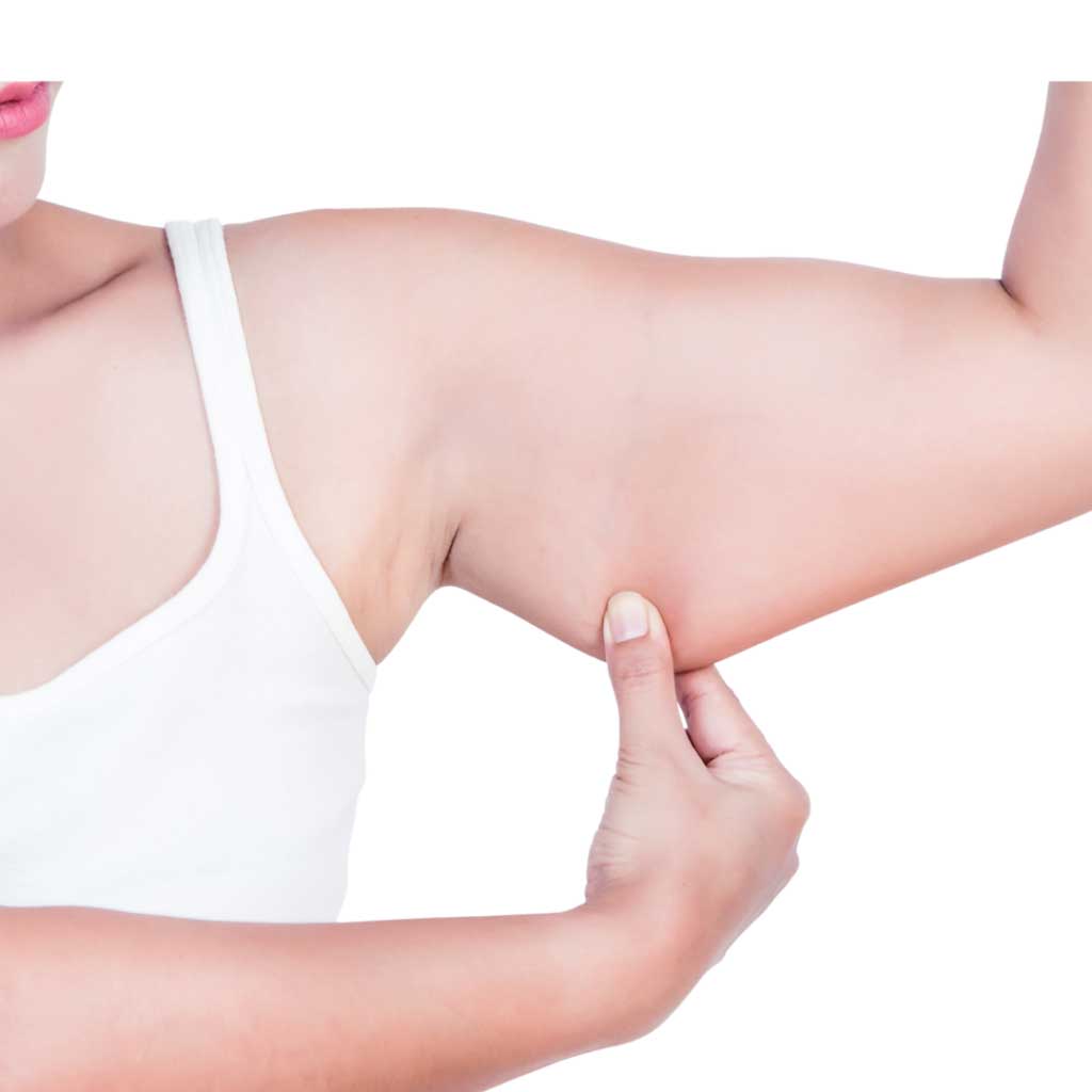 Vorberg Beauty Clinics Oberarmstraffung Vorberg Beauty Clinics Oberarmstraffung
