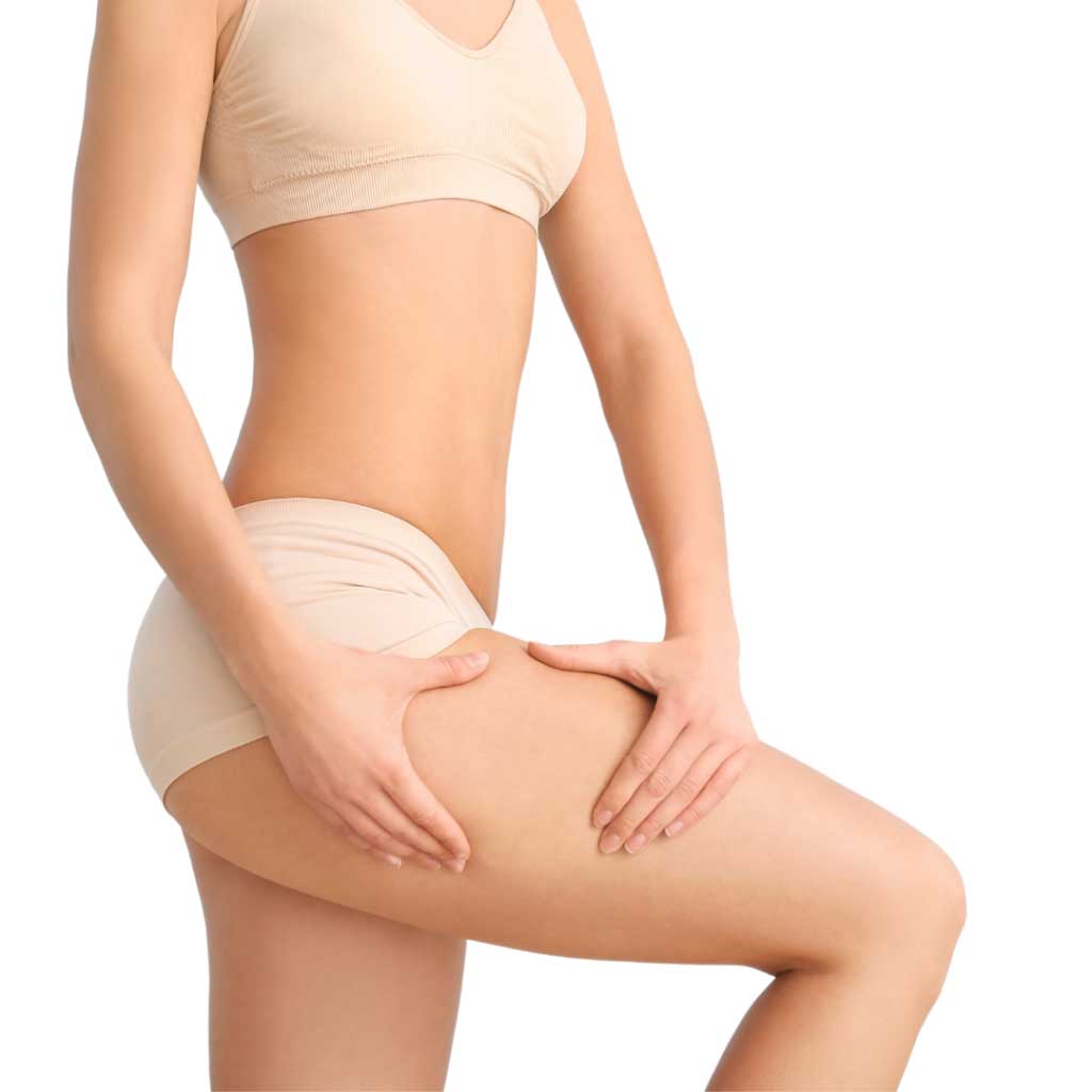 Vorberg Beauty Clinics Oberschenkelstraffung Vorberg Beauty Clinics Oberschenkelstraffung